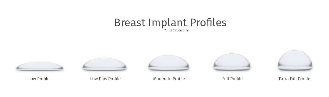 What does a breast implant profile mean? - AI Plastic Surgery