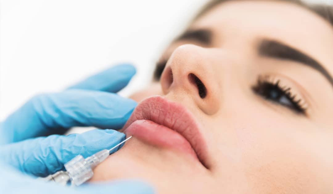 How to Reduce Swelling After Juvederm Lip Injections - AI Plastic Surgery